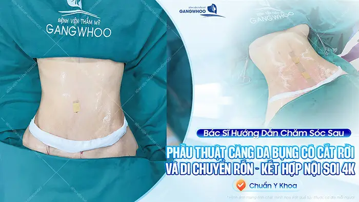 cham soc sau khi cang da bung