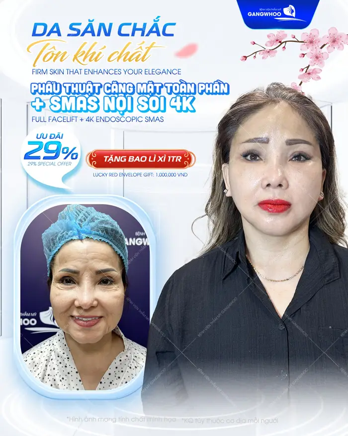 Da săn chắc tôn khí chất làm đẹp đón xuân nhận ngay lì xì 1 triệu đồng tại BVTM Gangwhoo