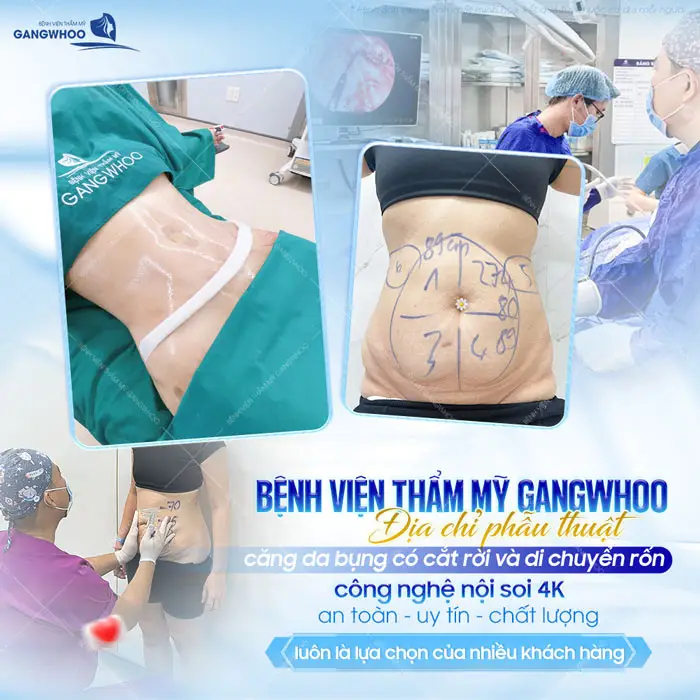 Top 8 Địa Chỉ Căng Da Bụng Uy Tín Tại TPHCM Được Nhiều Khách Hàng Lựa Chọn 2 Top 8 Địa Chỉ Căng Da Bụng Uy Tín Tại TPHCM Được Nhiều Khách Hàng Lựa Chọn