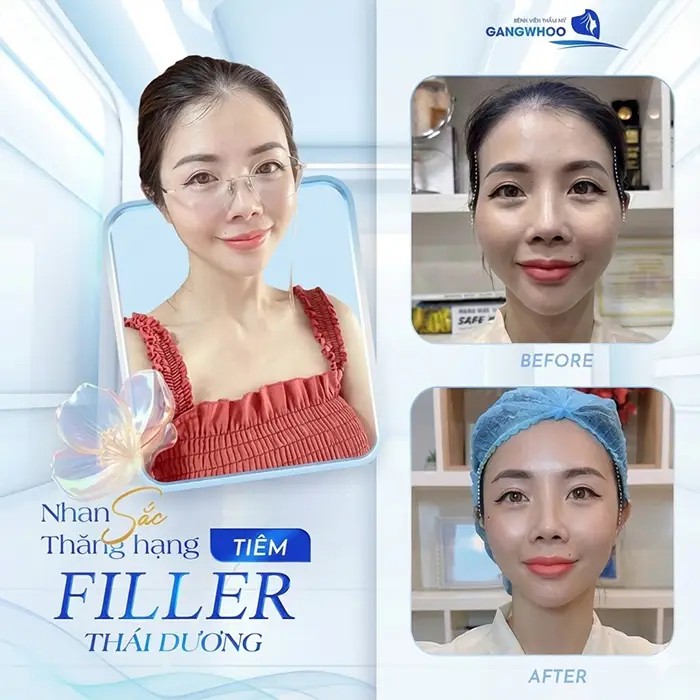 Độn Thái Dương Bằng Chất Liệu Gì? 3 Chất Liệu Thường Dùng