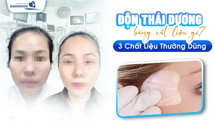 don thai duong bang chat lieu gi