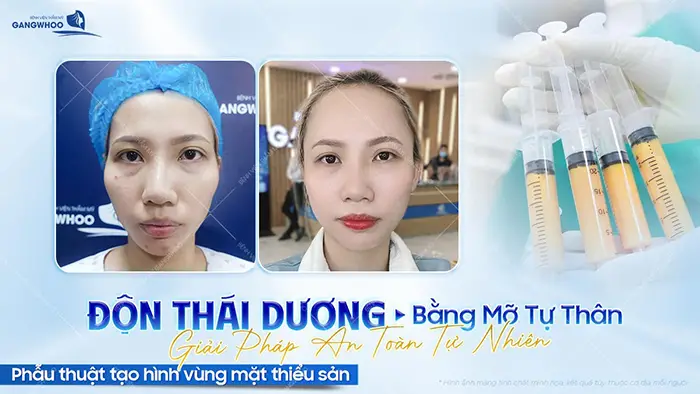 don thai duong bang mo tu than