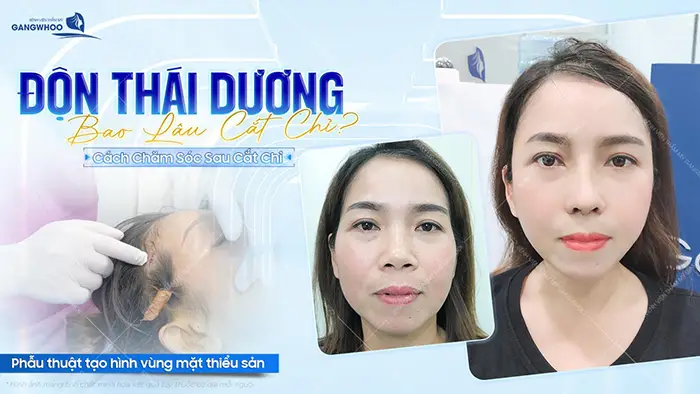 don thai duong bao lau duoc cat chi