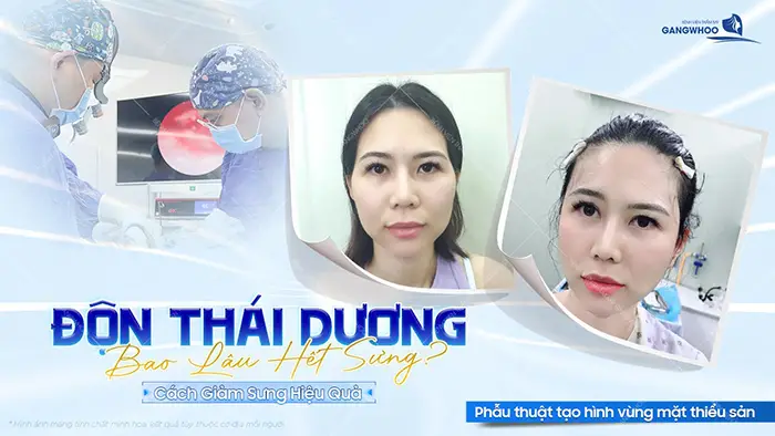 don thai duong bao lau het sung