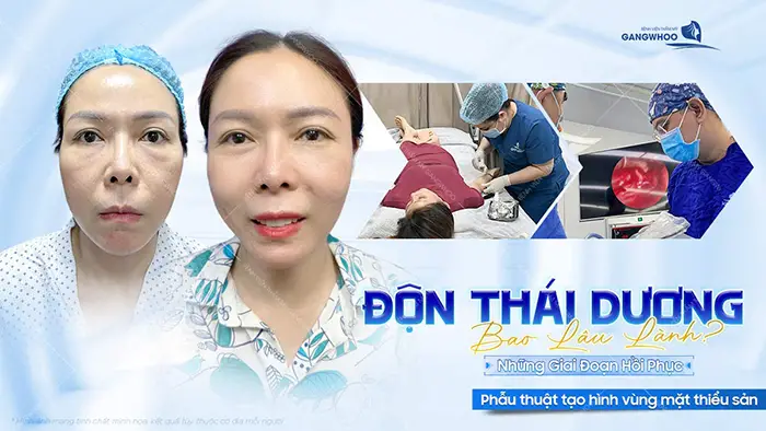 don thai duong bao lau thi lanh