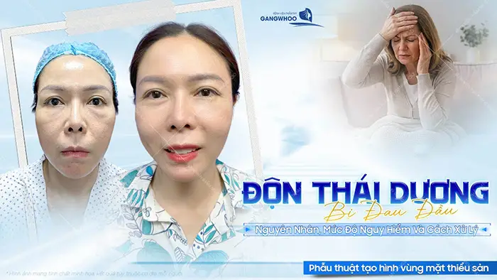 don thai duong bi dau dau