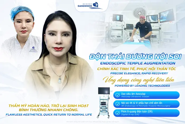 Độn Thái Dương Có Bị Lộ Không? Nguyên Nhân Và Cách Xử Lý