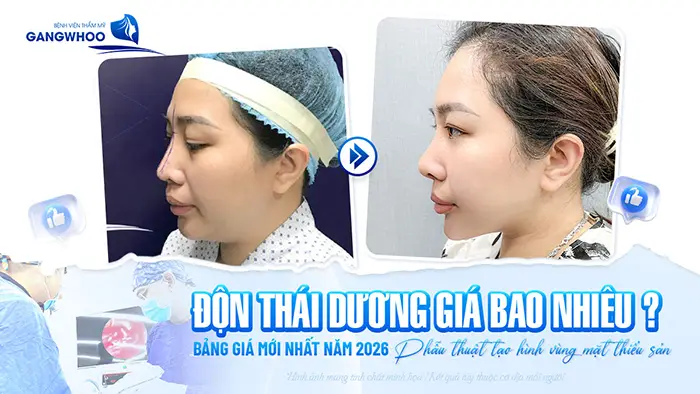 don thai duong gia bao nhieu