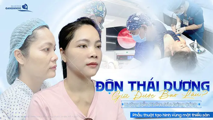 don thai duong giu duoc bao lau