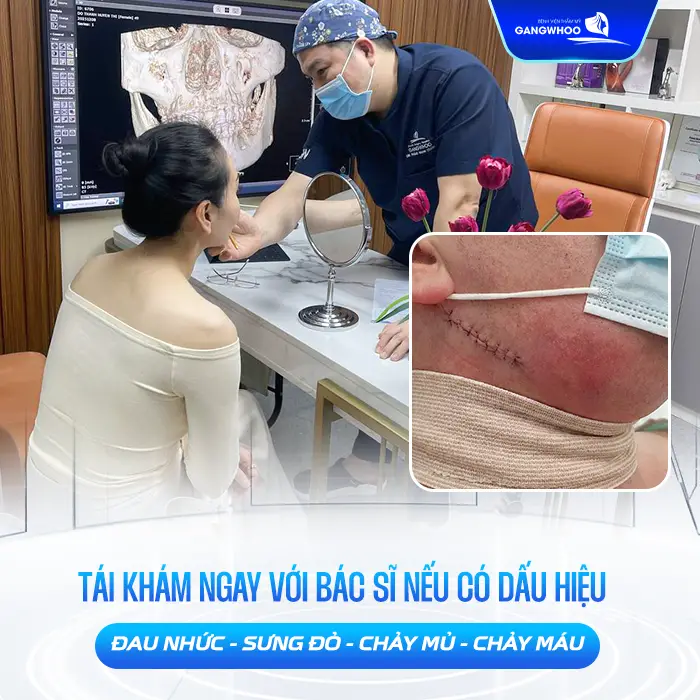 Gọt Hàm Bao Lâu Cắt Chỉ? Hướng Dẫn Chăm Sóc Sau Cắt Chỉ