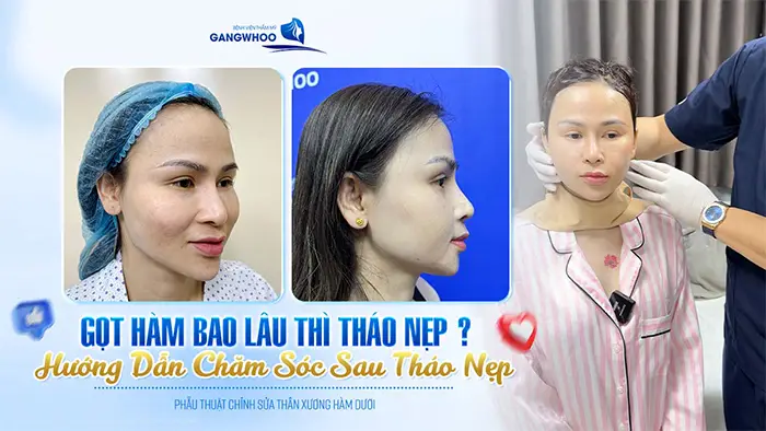 got ham bao lau thi thao nep