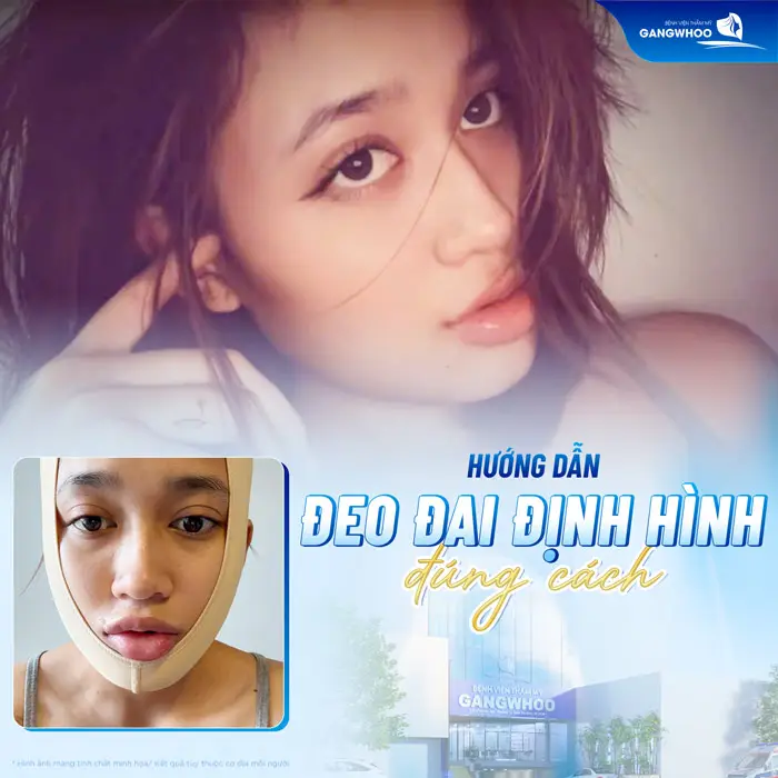 Gọt Hàm Đeo Đai Định Hình Bao Lâu? Hướng Dẫn Đeo Đai Đúng Cách