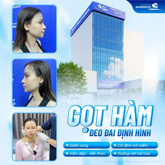 Gọt Hàm Đeo Đai Định Hình Bao Lâu? Hướng Dẫn Đeo Đai Đúng Cách