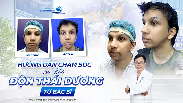 huong dan cham soc sau khi don thai duong