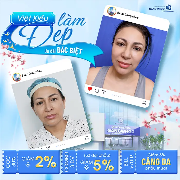 Gangwhoo Thông Báo Lịch Làm Việc Tết 2026: Mở Ra Cơ Hội Làm Đẹp Cuối Năm Nhiều Ưu Đãi Lớn