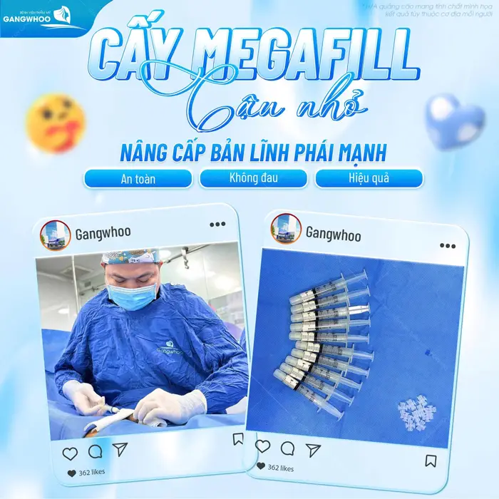 Cấy mỡ Megafill "cậu nhỏ" nâng cấp bản lĩnh phái mạnh an toàn, không đau và hiệu quả dài lâu 
