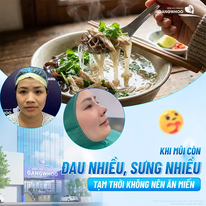 Nâng Mũi Ăn Miến Được Không? Bao Lâu Thì Ăn Được?