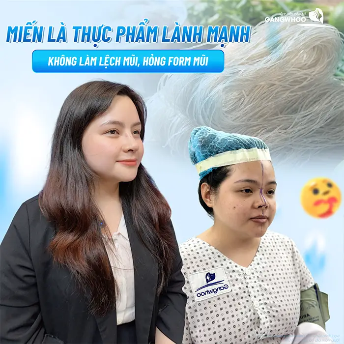 Nâng Mũi Ăn Miến Được Không? Bao Lâu Thì Ăn Được?