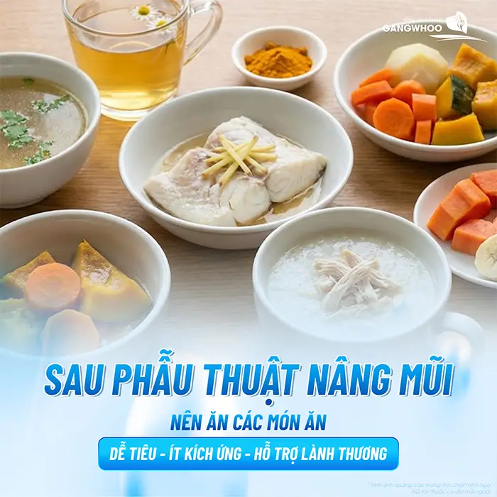 Nâng Mũi Ăn Miến Được Không? Bao Lâu Thì Ăn Được?