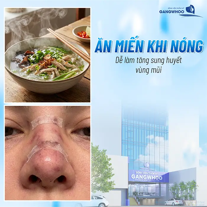 Nâng Mũi Ăn Miến Được Không? Bao Lâu Thì Ăn Được?