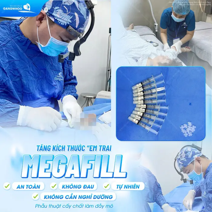 Tăng kích thước "em trai" Megafill an toàn không đau, không cần nghỉ dưỡng