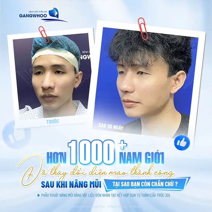 Review 10 Địa Chỉ Nâng Mũi Nam Đẹp Tại TPHCM