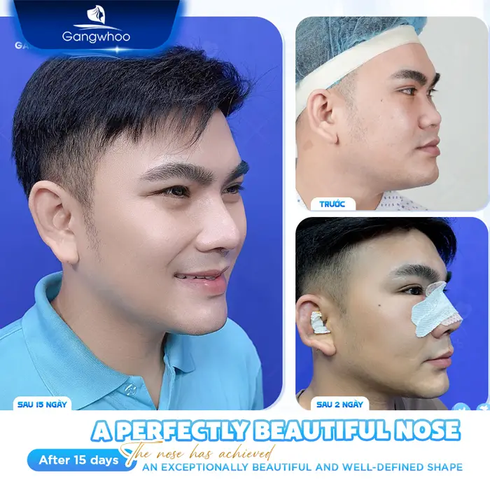 dia chi nang mui tai tphcm 1