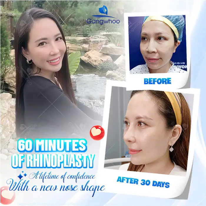 dia chi nang mui tai tphcm 4