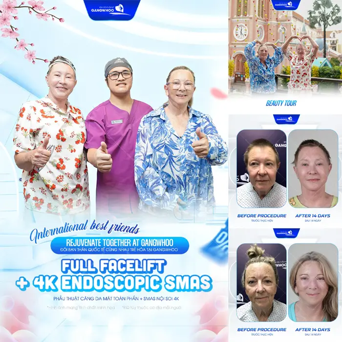Hành Trình Níu Giữ Tuổi Xuân Của Đôi Bạn Thân 40 Năm Tại BVTM Gangwhoo 3 Phẫu thuật căng da mặt toàn phần Smas nội soi 4K da đẹp căng mịn, trẻ đẹp ngay sau phẫu thuật