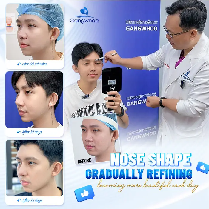 en bang gia nang mui va sua mui 3