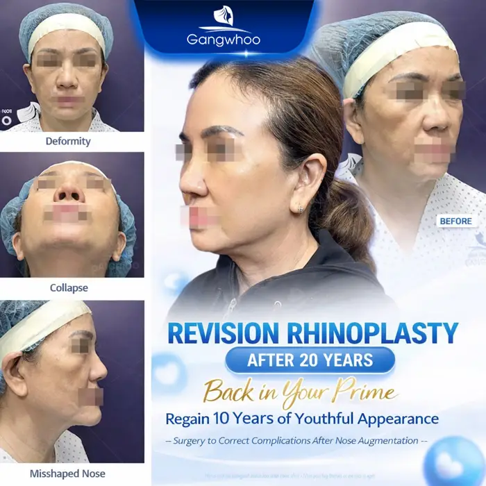 en bang gia nang mui va sua mui 6