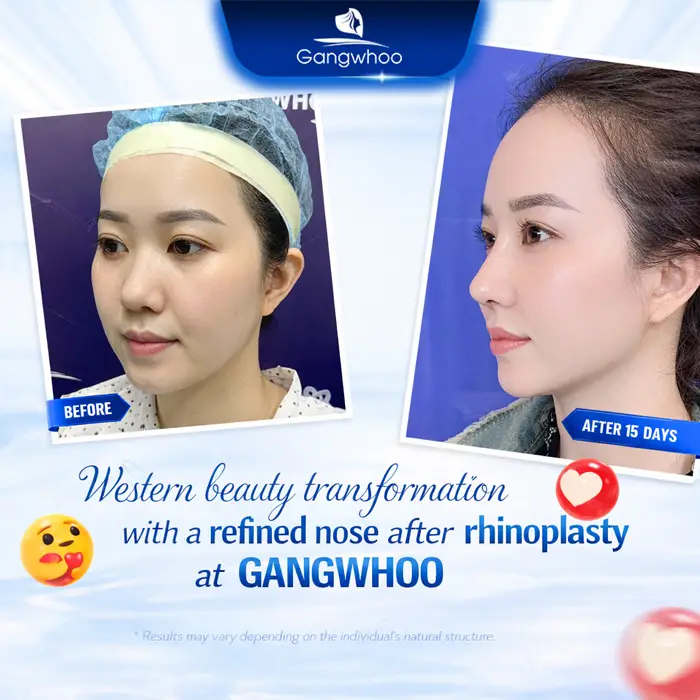 en bang gia nang mui va sua mui 8