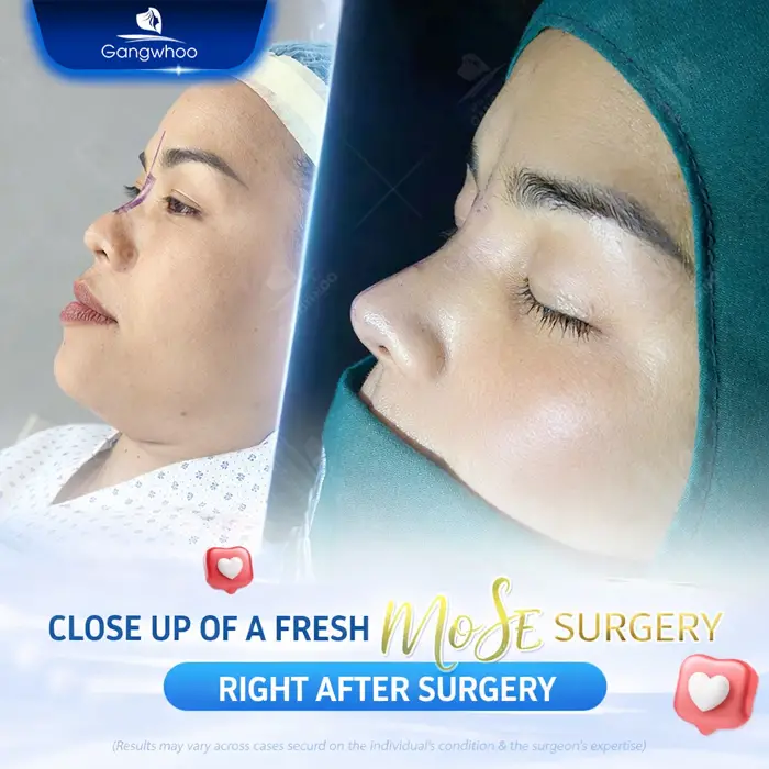 en nang mui da mui mong 1