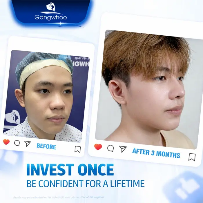 en nang mui da mui mong 2