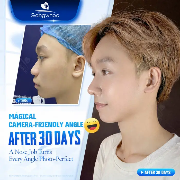 en nang mui da mui mong 3