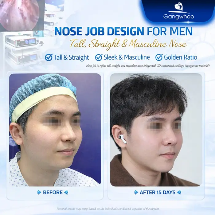 en nang mui da mui mong 4