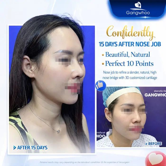 en nang mui da mui mong 5