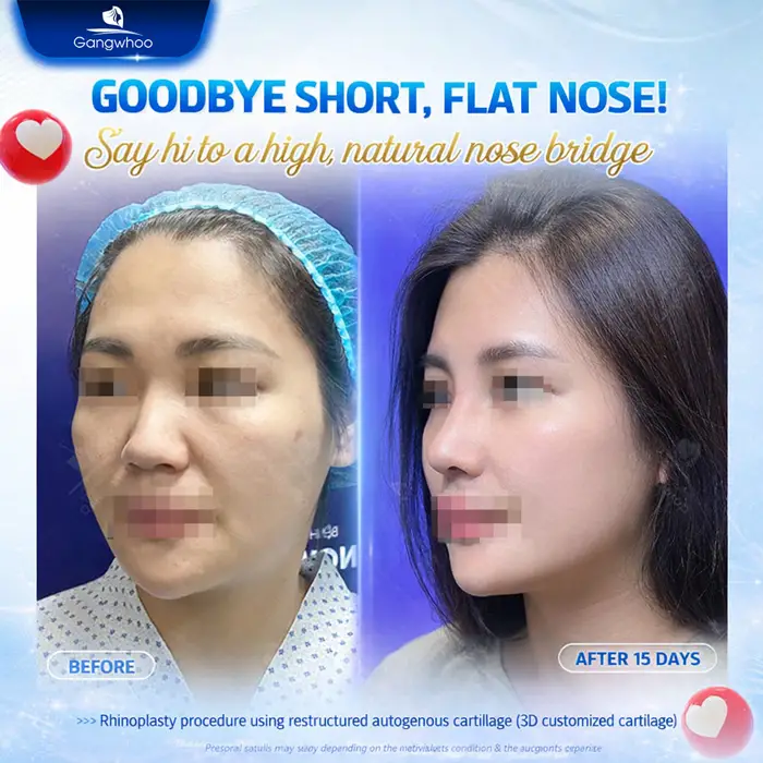 en nang mui da mui mong 6