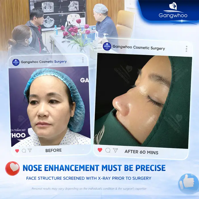 en nang mui da mui mong 7