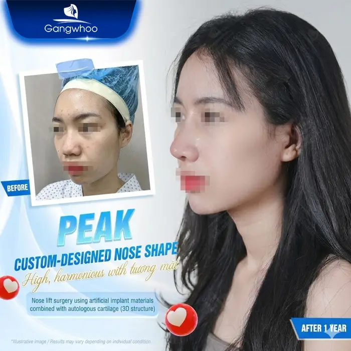 en nang mui phong thuy 1