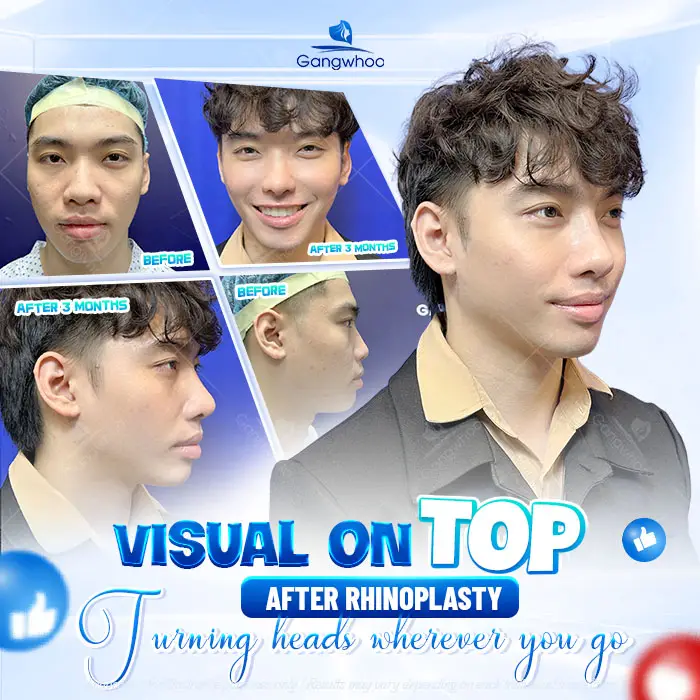 en nang mui phong thuy 3