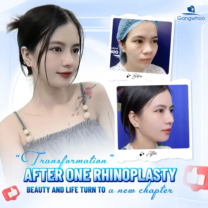 en nang mui phong thuy 4