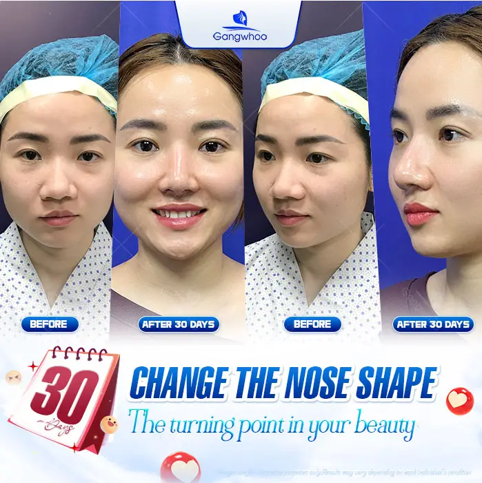 en nang mui phong thuy 5