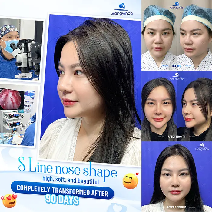 en nang mui phong thuy 6