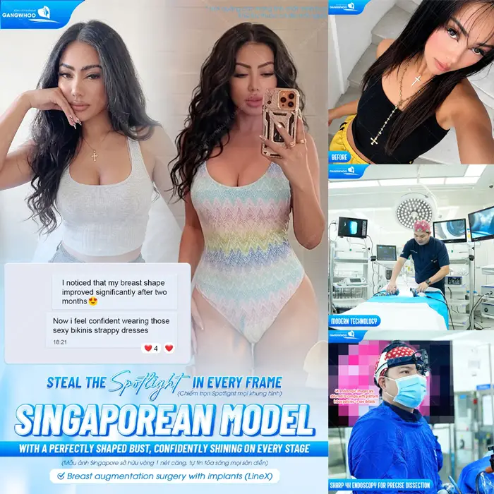 Khách hàng tự tin diện Bikini cực cháy sau phẫu thuật nâng cấp vòng 1 tại bệnh viện thẩm mỹ Gangwhoo 