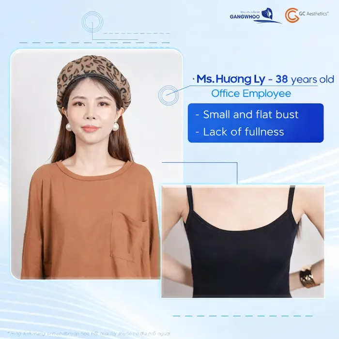 At 38, her bust lacked fullness and roundness