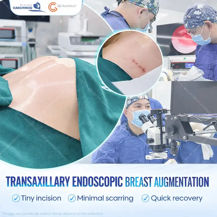 Armpit approach with small incision and quick recovery