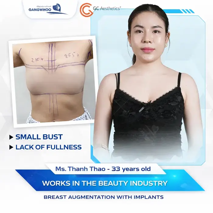 Her small bust had been her concern for many years