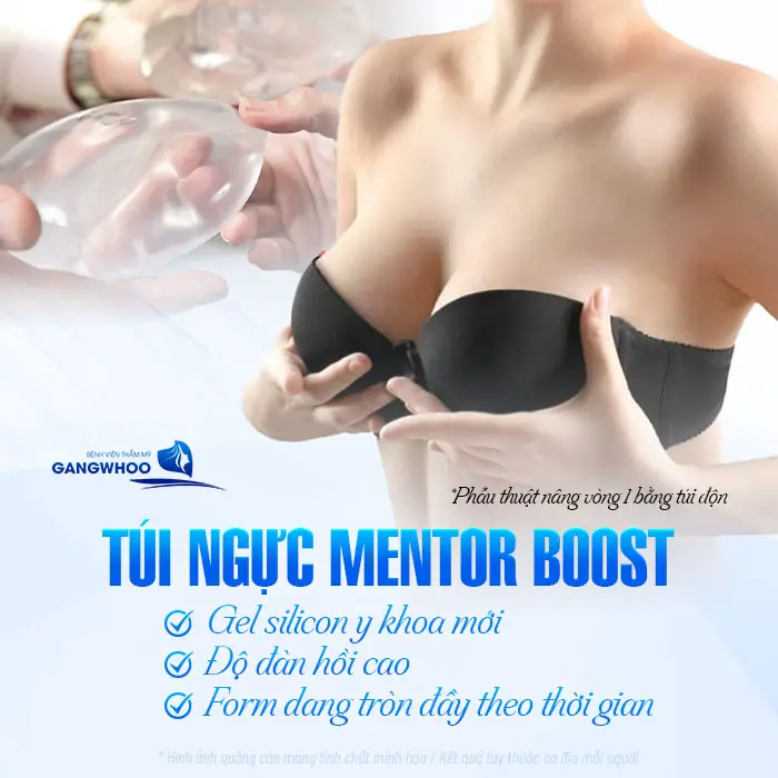 Nâng Ngực Túi Mentor Boost: Vòng 1 Chuẩn Đẹp, Mềm Mại & Tự Nhiên Dài Lâu