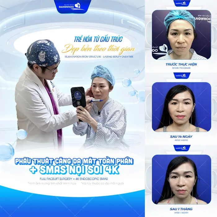 Top 8 Bác Sĩ Căng Da Mặt Nổi Tiếng Với Tay Nghề Cao